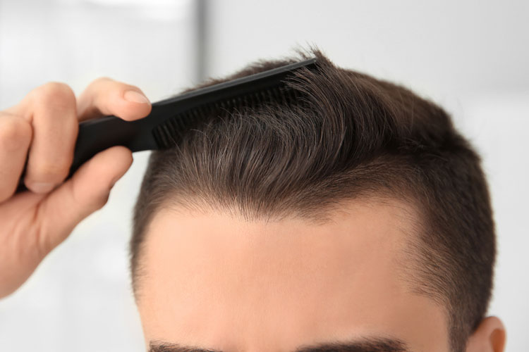 Comment réparer une chute de cheveux en recul