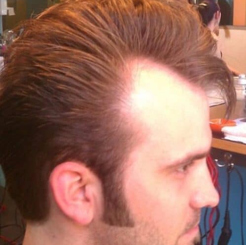 les coiffures elvis pour les hommes avec des lignes de cheveux en recul
