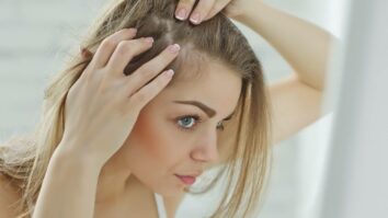 Comment arrêter la chute de cheveux chez la femme ?