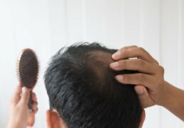 Comment arrêter la chute des cheveux homme ?