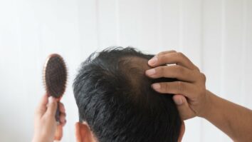 Comment arrêter la chute des cheveux homme ?