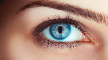 Comment avoir de beau yeux bleu ?