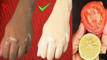 Comment blanchir la peau naturellement et rapidement ?