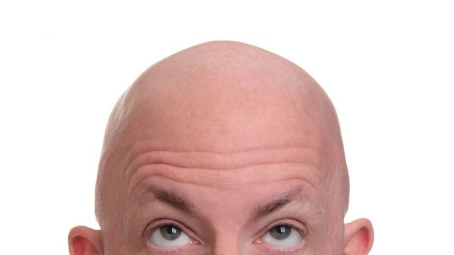 Comment cacher un crâne plat ?