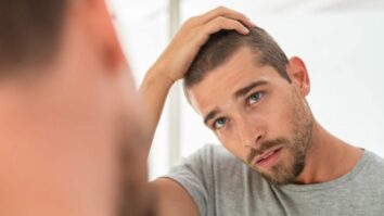 Comment cacher un début de calvitie ?