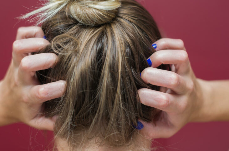 Comment calmer les démangeaisons du cuir chevelu ?