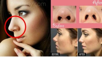 Comment changer la forme de la tête ?