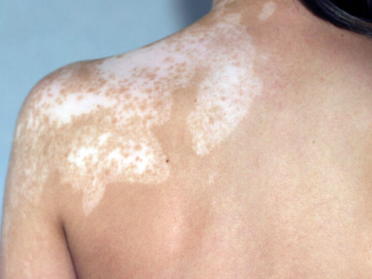 Comment enlever la peau blanche de la raie ?