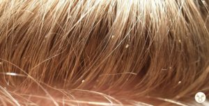 Comment enlever les petit cheveux electrique ?