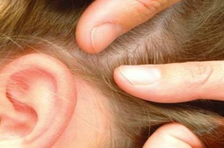 Comment enlever les petit cheveux sur la tête ?