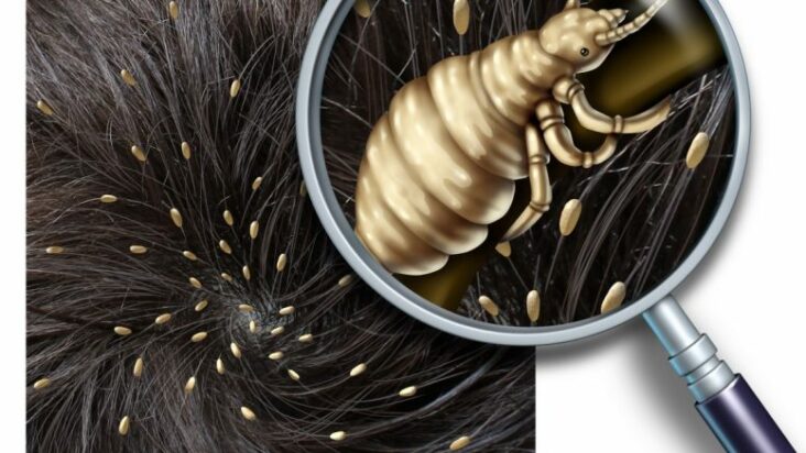 Comment enlever les petits cheveux Au-dessus de la tête ?