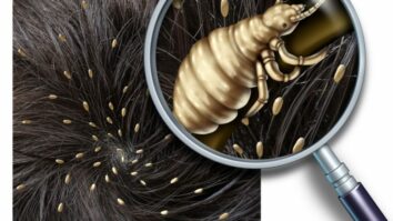 Comment enlever les petits cheveux sur la tête ?