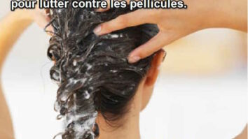 Comment enlever pellicule naturellement ?