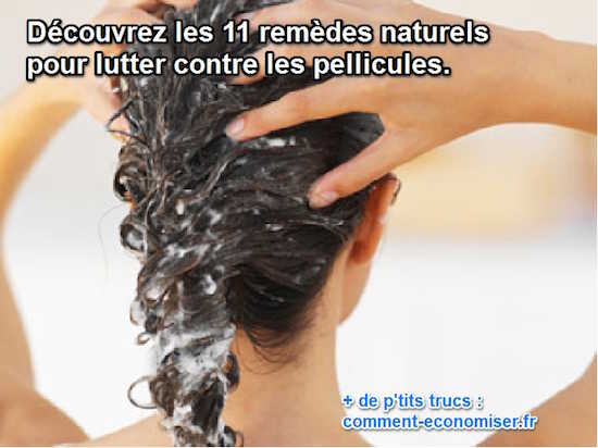 Comment enlever pellicule naturellement ?