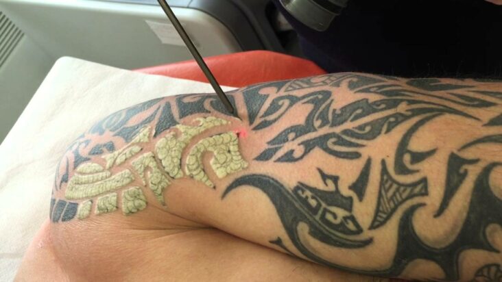 Comment enlever un tatouage Semi-permanent naturellement ?