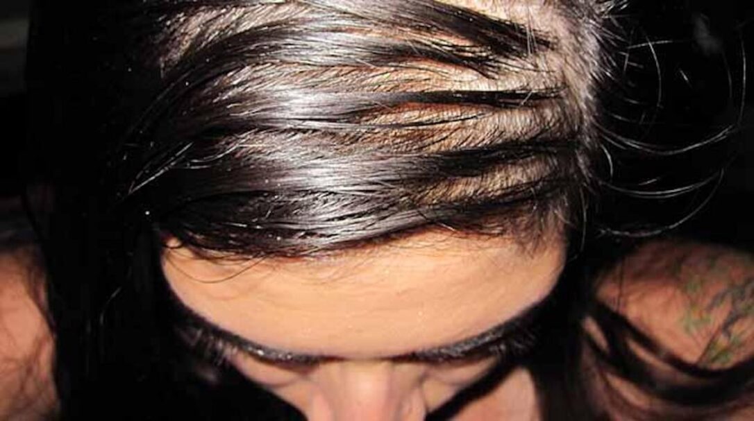 Les Cheveux Blancs Peuvent Ils Redevenir Noirs Comment faire pour ne plus avoir de cheveux blancs