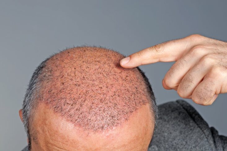 Comment faire pousser les poils sur le corps ?