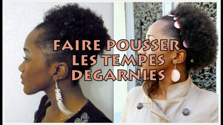 Comment faire pousser les tempes dégarnies ?