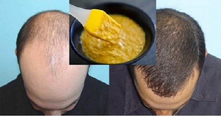 Comment faire pousser ses cheveux avec du jaune d'œuf ?