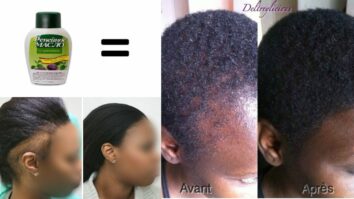 Comment faire pousser ses cheveux plus vite homme noir ?