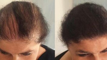 Comment faire repousser les cheveux clairsemés ?