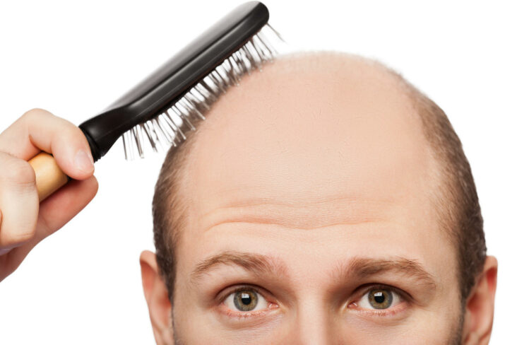 Comment faire repousser les cheveux d'un homme ?