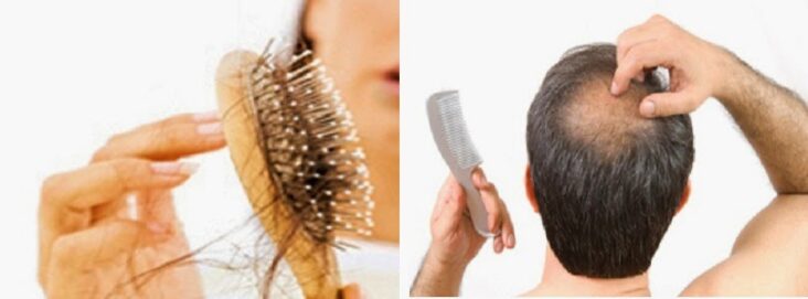 Comment lutter contre la chute de cheveux hormonale ?