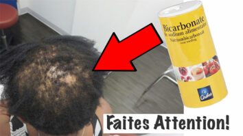 Comment mettre du bicarbonate de soude sur les cheveux ?