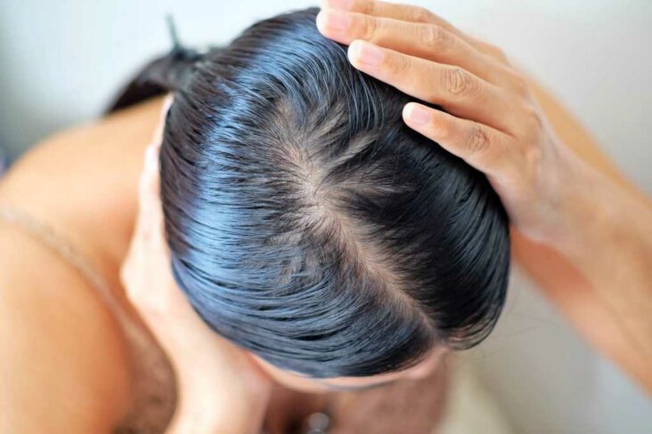 Comment réguler le sébum cheveux ?
