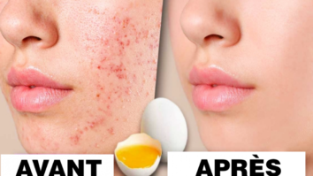 Comment resserrer les pores du visage naturellement ?