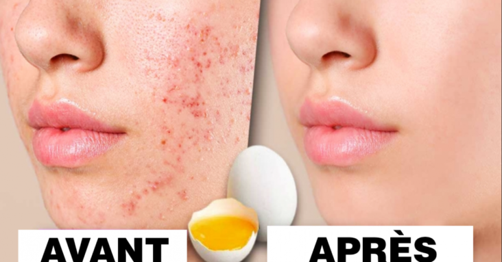 Comment resserrer les pores du visage naturellement ?
