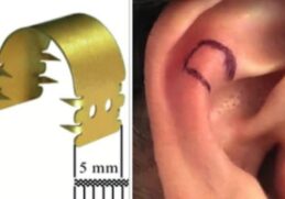 Comment rétrécir ses oreilles sans chirurgie ?