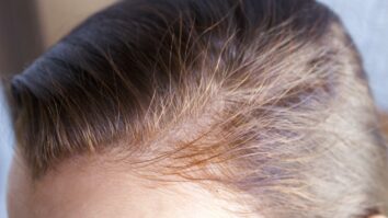 Comment retrouver ses cheveux blancs après coloration ?