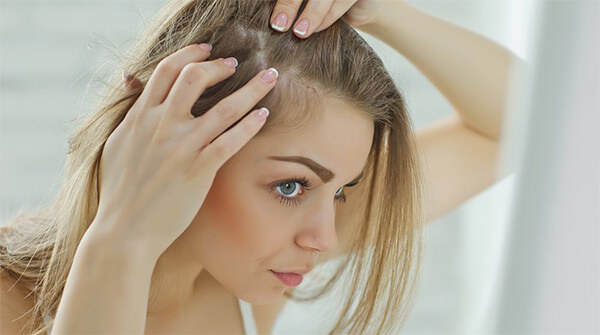 Comment savoir si une chute de cheveux est hormonale ?