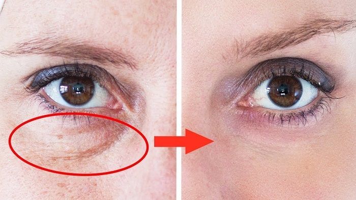 Comment se masser le visage pour enlever les rides ?