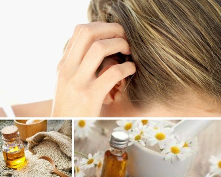 Comment soigner un cuir chevelu qui démange ?