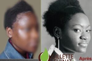 Comment traiter les cheveux naturels africains ?