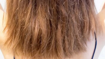 Comment traiter les cheveux secs et cassants ?