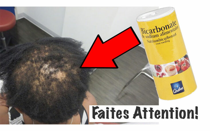 Est-ce que le bicarbonate fait pousser les cheveux ?