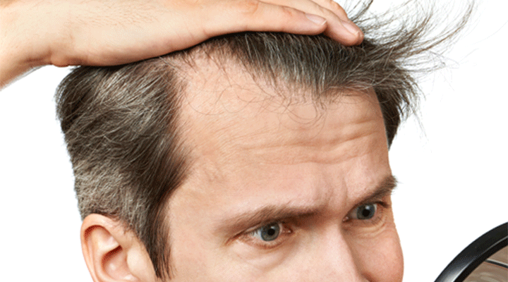 Est-ce que le henné provoque une chute des cheveux ?