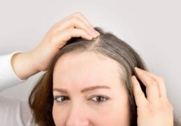 Est-ce que le stress donne des cheveux blancs ?