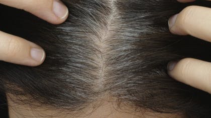 Pourquoi des cheveux blanc à 20 ans ?