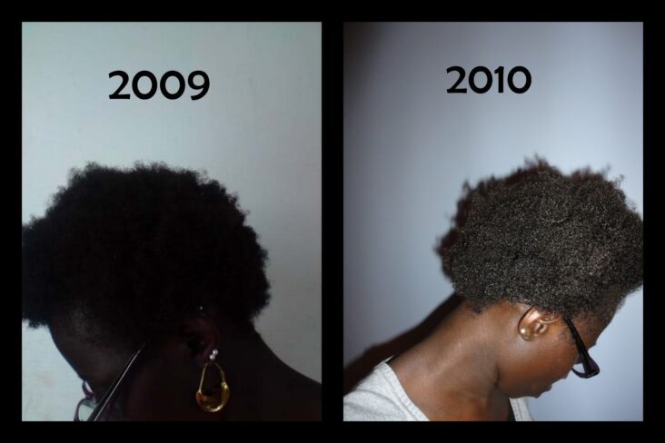 Pourquoi j'ai des baby hair ?