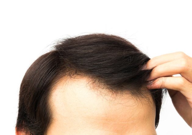 Pourquoi je perds mes cheveux plus que d'habitude ?