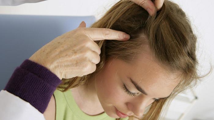Pourquoi le cuir chevelu fait mal ?