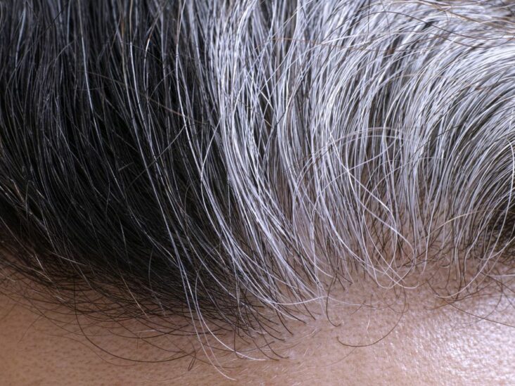 Pourquoi le stress rend les cheveux blancs ?