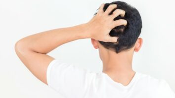 Pourquoi ma tête gratte ?
