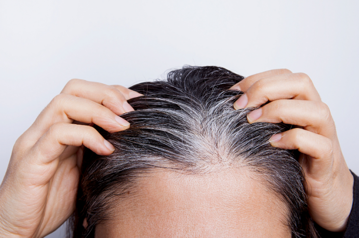 Pourquoi mes cheveux blancs redeviennent noirs ?