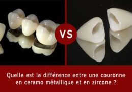 Quelle est la différence entre une couronne et un diadème ?