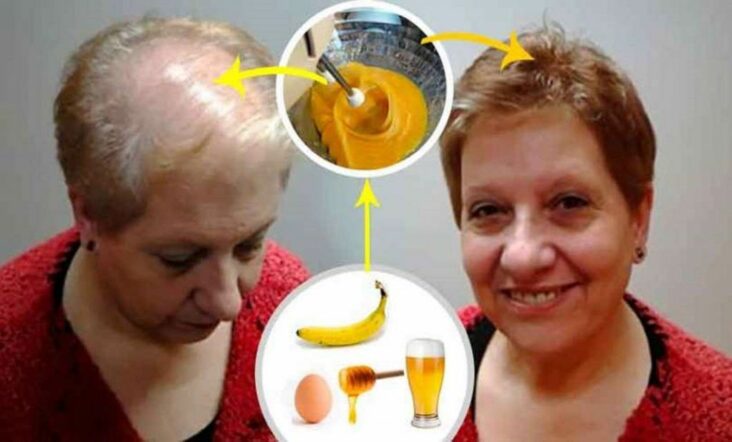 Quelle produit pour faire pousser les cheveux rapidement ?